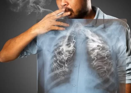 dampak buruk rokok bagi paru-paru