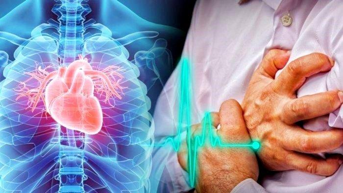 dan Dampaknya Terhadap Penyakit Jantung