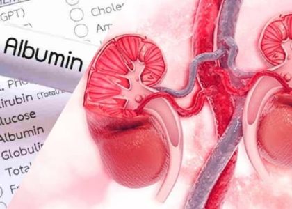 kesehatan ginjal dan albumin
